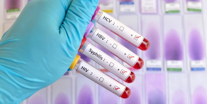 17€ Πλήρες Πακέτο Ελέγχου Αφροδίσιων Νοσημάτων (ΣΜΝ)